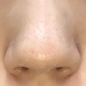 HANABI整形外科口コミ