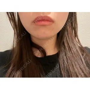 ルラ美容クリニック ルラ美容クリニック 池袋院口コミ