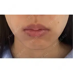 EMMO FACE CLINIC EMMO FACE CLINIC 大宮院口コミ