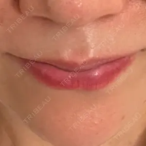 ルラ美容クリニック ルラ美容クリニック銀座院口コミ