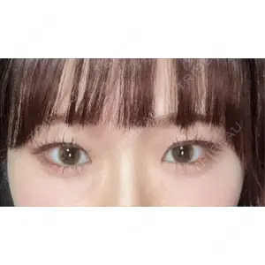 口コミ