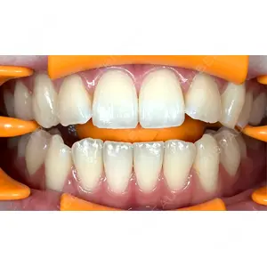 アンデルト歯科・矯正歯科口コミ