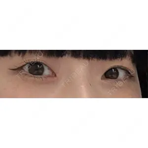 口コミ