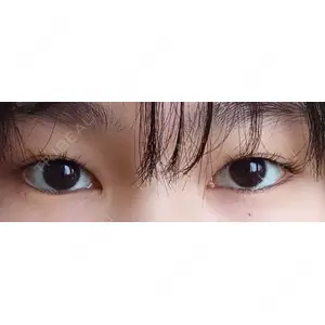 口コミ