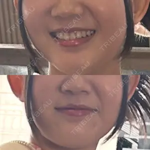 口コミ
