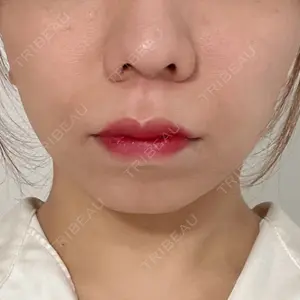 口コミ