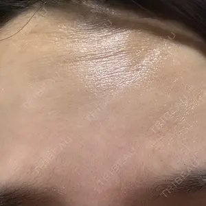 TCB東京中央美容外科 TCB東京中央美容外科 名古屋栄院口コミ