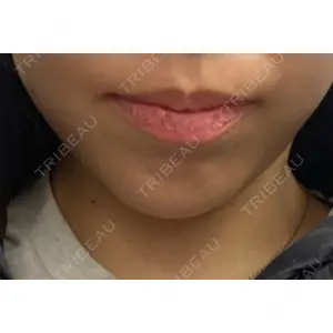 DMTC美容皮膚科 DMTC美容皮膚科 渋谷院口コミ
