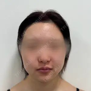 口コミ