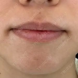 ルラ美容クリニック ルラ美容クリニック 大阪本院口コミ