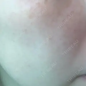 ルラ美容クリニック ルラ美容クリニック 仙台院口コミ