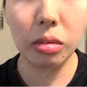 DMTC美容皮膚科 DMTC美容皮膚科 日本橋院口コミ