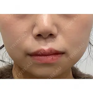 GRACY TOKYO CLINIC【グレイシートウキョウクリニック】口コミ