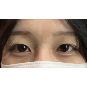 口コミ