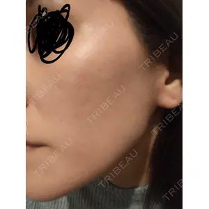 DAILY SKIN CLINIC DAILY SKIN CLINIC 心斎橋院口コミ