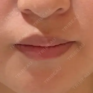 R Beauty CLINIC R Beauty CLINIC 銀座院口コミ