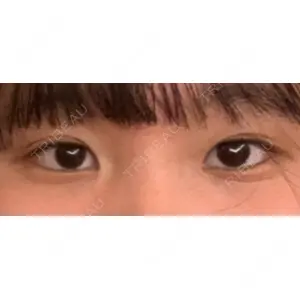 東京BELLEZZAクリニック口コミ