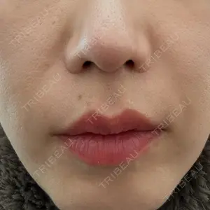 BiBiクリニック口コミ