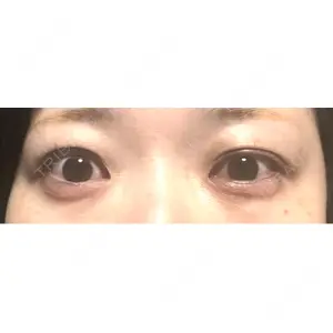 口コミ