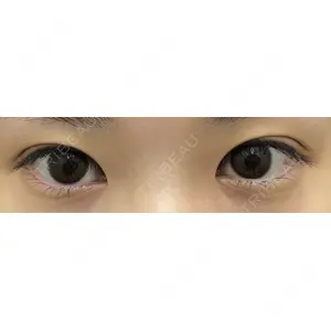 渋谷の森クリニック口コミ