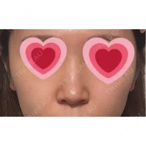 口コミ