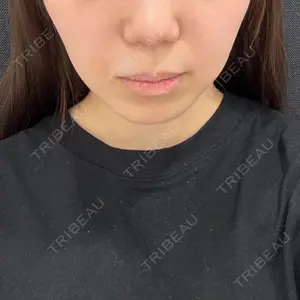 東京シンデレラ美容外科 東京シンデレラ美容外科 池袋院口コミ
