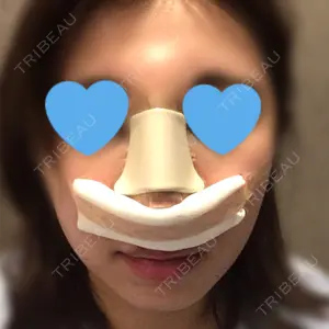HANABI整形外科口コミ