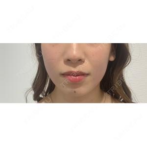 口コミ