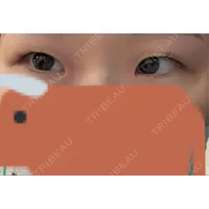 X CLINIC X CLINIC 大阪院口コミ