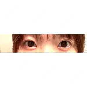 口コミ