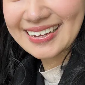 口コミ