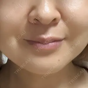 TCB東京中央美容外科 TCB東京中央美容外科 高田馬場院口コミ