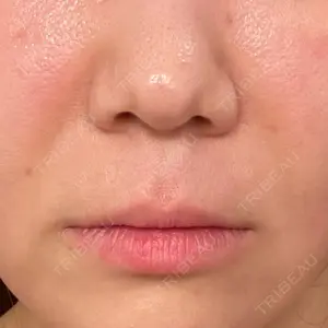ミラクリニック ミラクリニック 池袋院口コミ