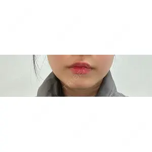 形成外科と美容外科のクリニック池袋口コミ