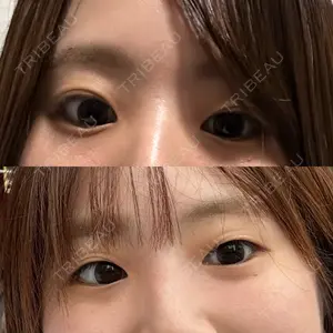 口コミ