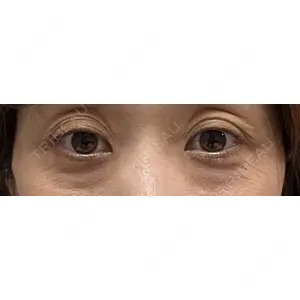 東京BELLEZZAクリニック口コミ