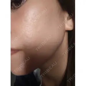 心斎橋KT美容クリニック口コミ
