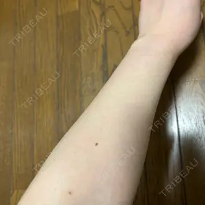 DAILY SKIN CLINIC DAILY SKIN CLINIC 心斎橋院口コミ