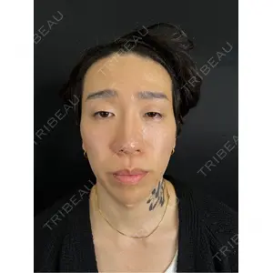 藤・ナチュレ美容クリニック 藤・ナチュレ美容クリニック 銀座院口コミ