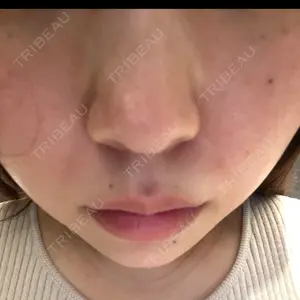 エトワールレジーナクリニック 新宿院口コミ