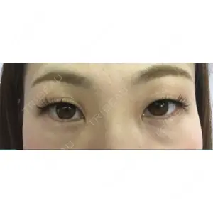 品川美容外科 品川美容外科 福岡院口コミ