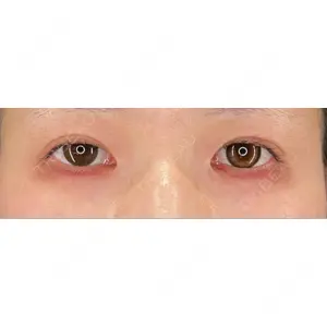 HAAB×DREAM BEAUTY CLINIC HAAB×DREAM BEAUTY CLINIC 大阪梅田院口コミ