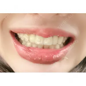 目黒まついデンタルクリニック口コミ