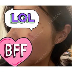 CHARIS BEAUTY CLINIC口コミ