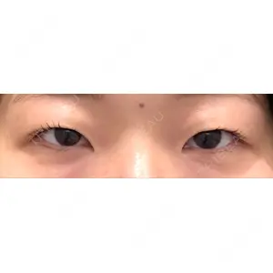 口コミ