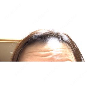TCB東京中央美容外科 TCB東京中央美容外科 中野院口コミ