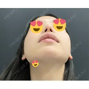 MIL CLINIC OSAKA口コミ