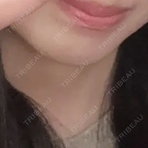 フォンタナクリニック天神口コミ