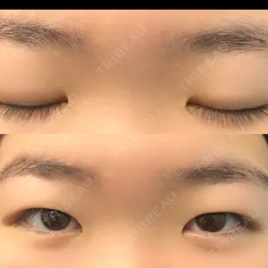 口コミ