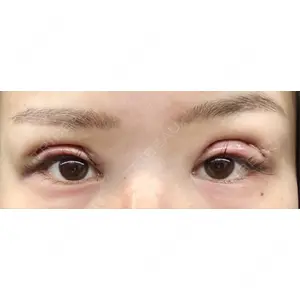 口コミ